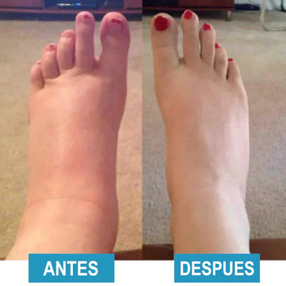 Paso® — alivio en cada paso